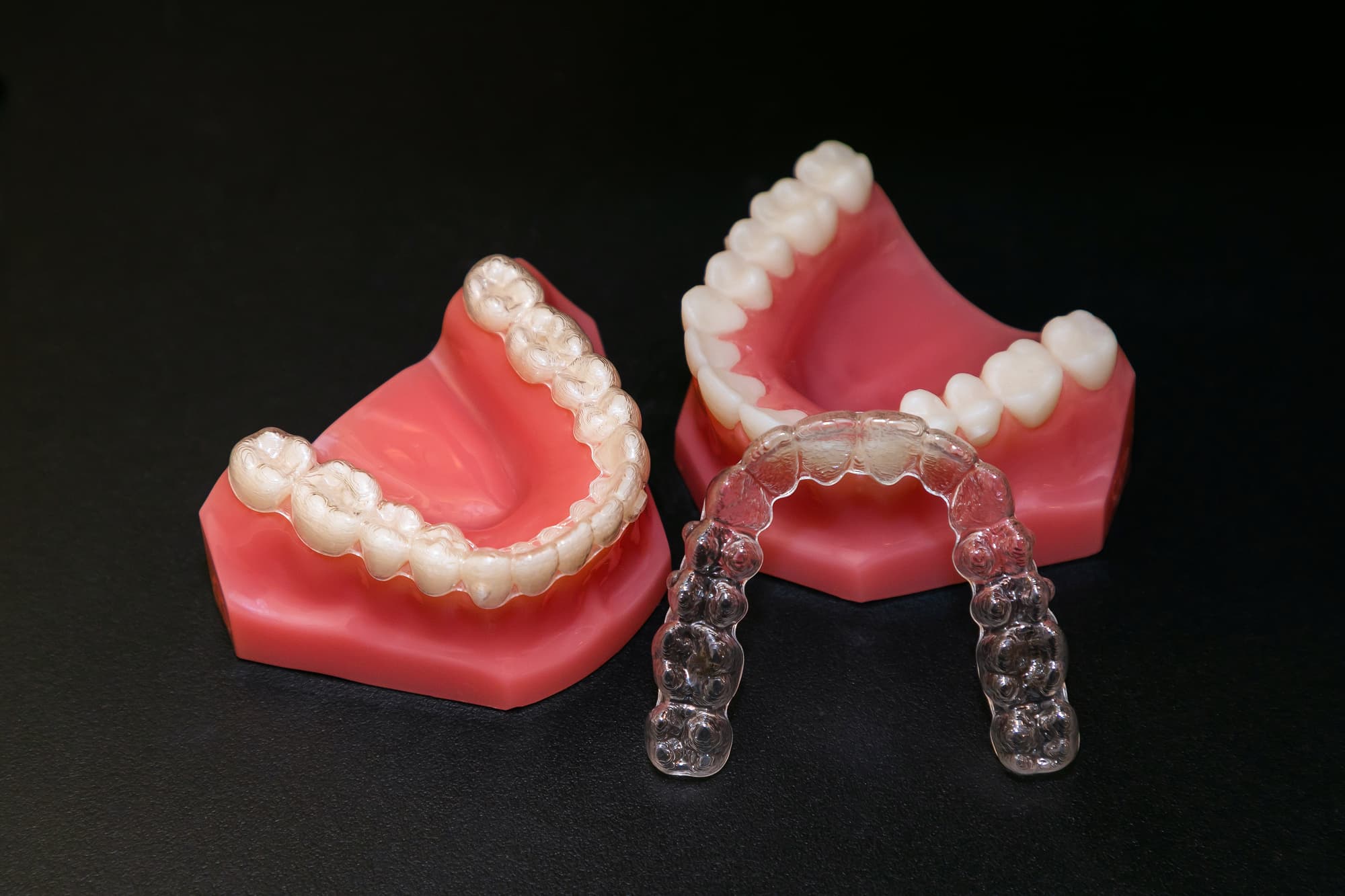 マウスピース矯正の期間は？保定期間はどれくらい？長引く要因とは