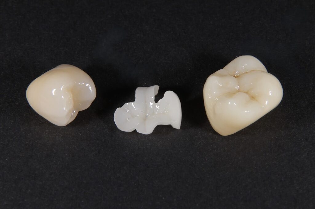 奥歯に使用されるセラミックの素材のイメージ