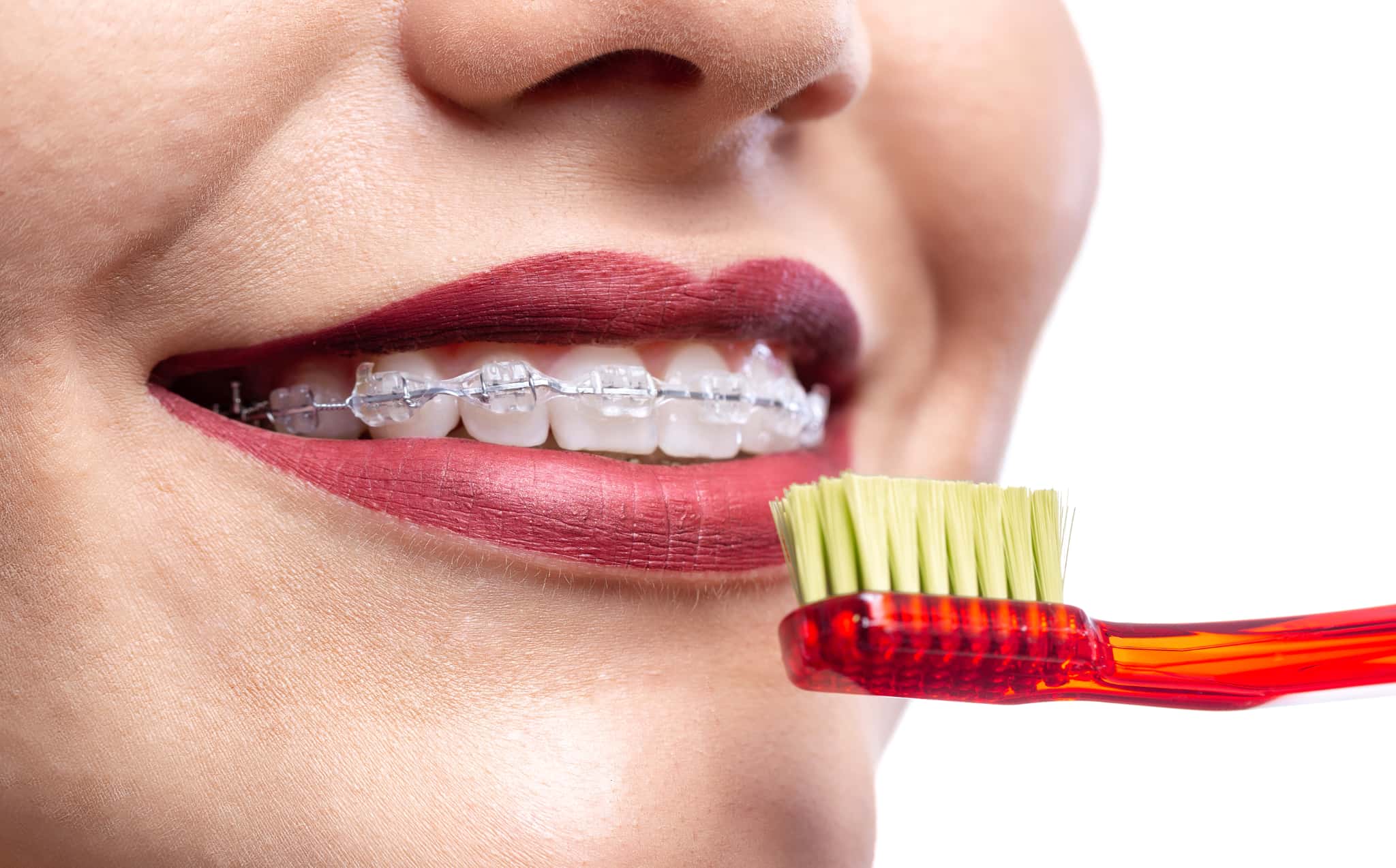 ワイヤー矯正中の歯磨き完全ガイド|やり方・回数・便利グッズも