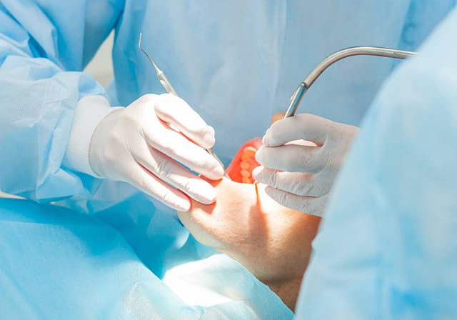 歯の手術を受ける男性