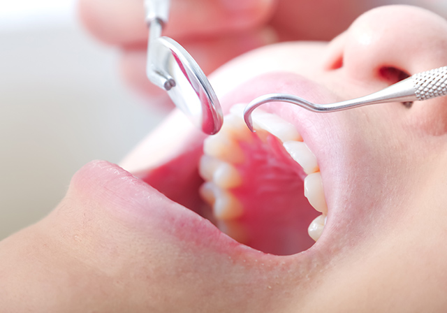 歯の治療を受ける女性の口元
